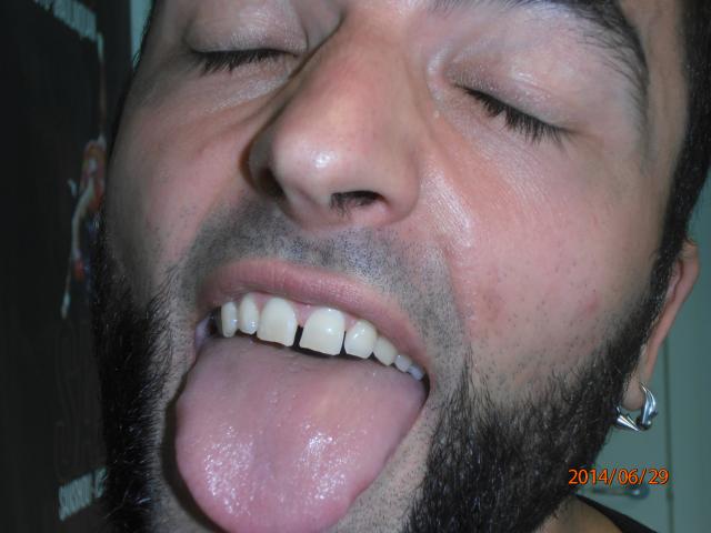 P6290222